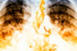 2012 08 20 15 44 40 922 Chest Xray Fire 70