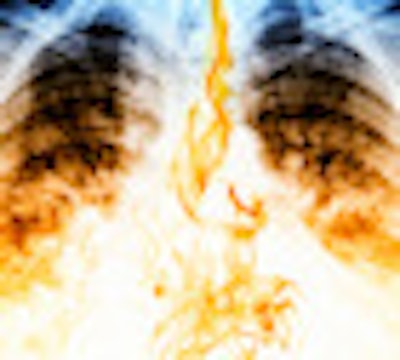 2012 08 20 15 44 40 922 Chest Xray Fire 70
