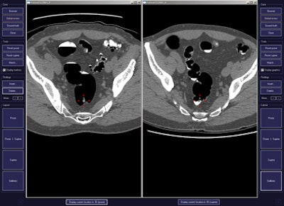 2012 08 30 15 42 42 7 Mang right bottom