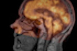 2012 09 04 12 10 49 16 2012 09 05 Kiessling Thumb