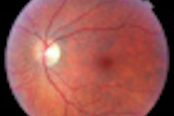 2012 09 11 13 54 34 429 Retina 70
