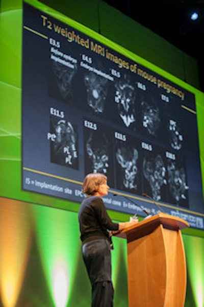 Neeman and her colleagues are using arterial spin labeling MRI to enable the unique identification of individual fetuses in a pregnant mouse.