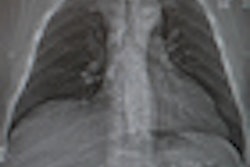 2012 09 17 12 10 55 667 2012 09 18 Esti Thumb