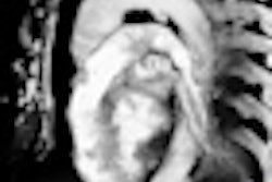 2012 09 18 12 21 52 37 2012 09 19 Chest Trauma Thumb