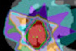2012 09 21 12 30 42 955 2012 09 24 Pet Guided Mri Thumb