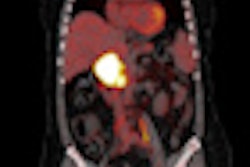 2012 09 28 12 36 54 948 2012 10 01 Pet Ct Thumb
