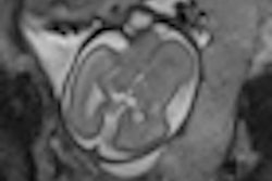 2012 10 08 08 07 26 925 2012 10 08 Placental Mri Thumb2