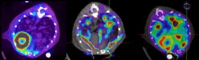 L-type amino acid transporter 2 (LAT2) transgenic mice PET/CT scan shows pulmonary adenocarcinoma. Left: F-18 FDG, middle: methionine-11C, right: choline-11C. All images courtesy of Drs. Fanti and Nanni.