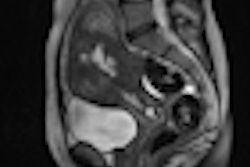 2012 10 10 09 48 35 774 2012 10 10 Pelvic Mri Thumb
