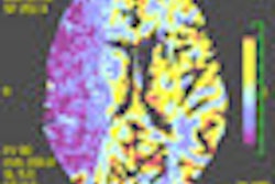 2012 10 10 12 32 59 319 2012 10 11 Ct Stroke Thumb
