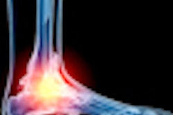 2012 10 16 11 36 32 388 Ankle 70