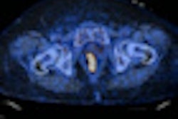 2012 10 18 12 57 43 281 2012 10 19 Mri Pet Ct Thumb