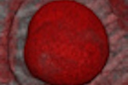 2012 10 23 13 48 07 684 2012 10 24 Ct Breast Implants Thumb2