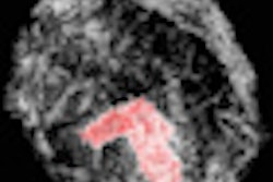 2012 10 25 12 40 19 390 Tomography Thumb