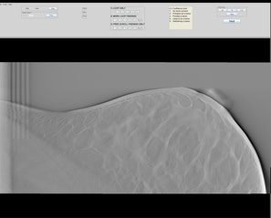 Example of the ViewDEX user interface showing a breast tomosynthesis slice in horizontal position.