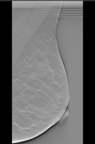 Example of the ViewDEX user interface showing a breast tomosynthesis slice in vertical position.