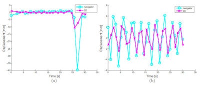 Overlap of 2D images and navigator measurements of the kidney during (a) breath-hold and the onset of breathing and (b) free breathing. During the breath-hold phase, both imaging modalities overlap and the phase of the free breathing is also equal.