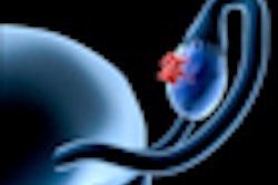 2012 11 06 10 30 14 893 Ovarian Cancer 70