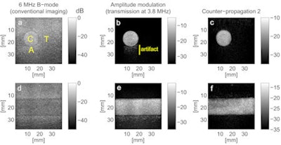 Images obtained with conventional B-mode imaging, amplitude modulation, and CP2. Labels C, T, and A show the areas used to calculate the contrast-to-tissue and artifact-to-contrast ratios.