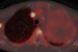 2012 11 08 11 54 04 87 2012 11 08 Pet Ct Thumb