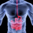 2012 11 12 11 44 19 892 Intestine2 70