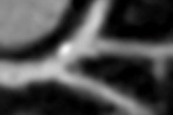 2012 11 13 10 36 56 718 Schoepf thumb 08 70x70