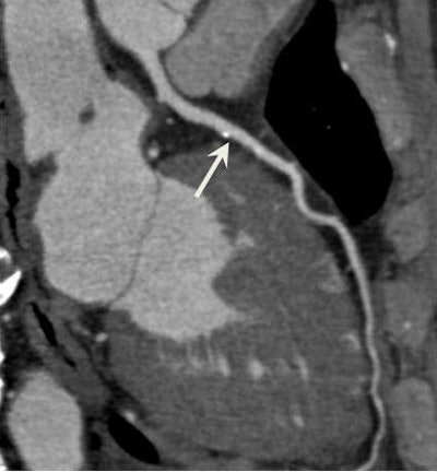 2012 11 21 11 52 29 707 2012 11 22 320 ccta Bottom