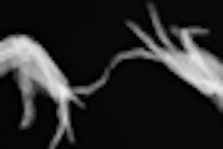 2012 11 26 17 33 01 747 Hand Dancing Thumb