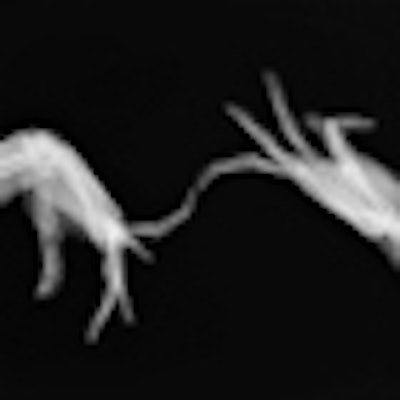 2012 11 26 17 33 01 747 Hand Dancing Thumb
