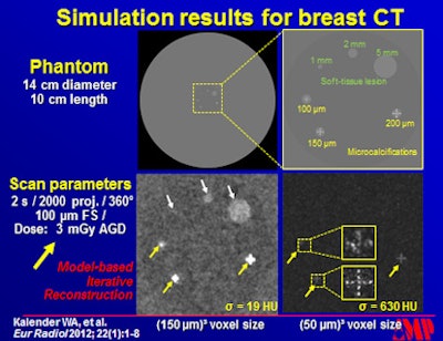 Phantoms used to assess the performance of breast CT. Top left: Homogeneous 14-cm diameter phantom with soft-tissue lesions and areas of microcalcifications. Top right: Magnified portion of left image with the structures labeled. Bottom images show image details with window settings for soft tissue (left) and for calcifications (right).