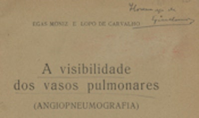 Fig. 8: Moniz and De Carvalho (1932) inscribed by Moniz: 'Hommage de Egas Moniz.'