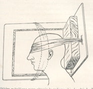 Fig. 3: Positioning for cerebral angiography (1932).
