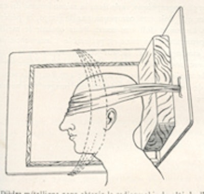 Fig. 3: Positioning for cerebral angiography (1932).