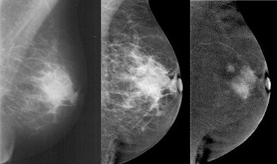 2012 12 11 10 28 02 428 2012 12 12 Ce Mammo2