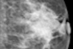 2012 12 11 10 28 03 306 2012 12 12 Ce Mammo Thumb