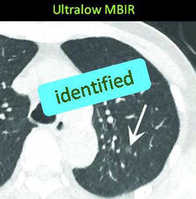2012 12 12 14 22 54 980 Katsura mbir detected bottom
