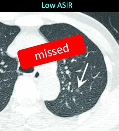 2012 12 12 14 22 56 350 Katsura asir missed top