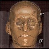 3D reconstruction