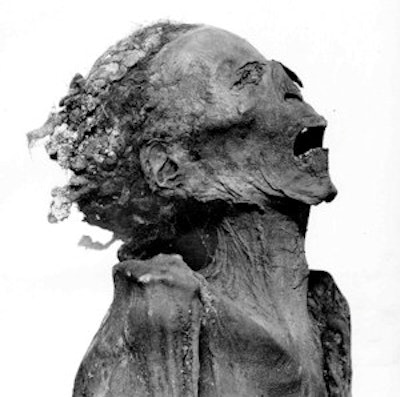 Left: Ramesses III, known as 'the Great God,' was found in the royal cache at Deir el-Bahari, one of the most beautiful temples in Egypt. Right: The mummy of 'unknown man E,' who was also found at Deir el-Bahari. His contorted expression, unusual mummification process, and goat skin were noted during the unwrapping of the mummy in 1886. He maybe Ramesses III's son, Pentawere. All images courtesy of Albert Zink,and Julia Reichert, European Academy of Bolzano/Bozen (EURAC) in Bolzano, Italy. Credit for both images: Catalogue général des antiquités égyptiennes du Musée du Caire: The Royal Mummies. Le Caire: Imprimerie de l'Institut français d'archéologie orientale, 1912 Catalogue General Antiquites Egyptiennes du Musee du Caire DT57.C2 vol 59 (public domain).