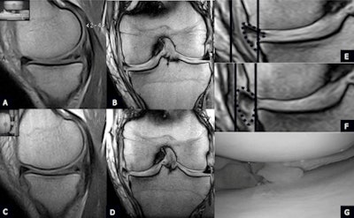 2012 12 27 15 30 54 736 Barile1 28dec12 450
