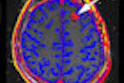 2011 10 12 11 09 04 145 Padhani Esr 12oct11 Thumb