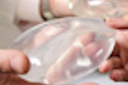 2012 01 04 13 38 52 972 Breast Implant 70