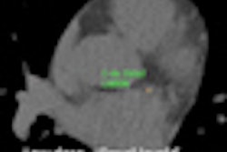 2012 12 31 11 11 39 794 Calciumscore 70