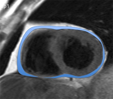 Short-axis view