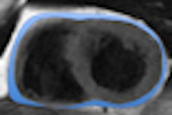 2013 01 15 08 44 40 858 2013 01 15 Epicardial Fat Thumb
