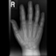 2013 01 18 11 25 14 205 2013 01 23 Radiographer Thumb
