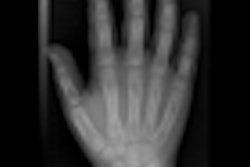 2013 01 18 11 25 14 205 2013 01 23 Radiographer Thumb