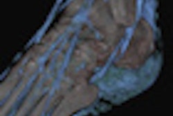 2013 01 23 07 39 46 960 2013 01 23 Msk Dose Thumb