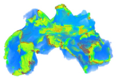 Simulated erratic electrical excitation waves during AF