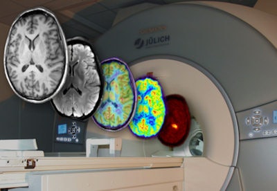 The 3-tesla PET/MRI system at the Research Centre Jülich has been integrated with an EEG system to provide millisecond resolution of brain activity in tandem with molecular images obtained using PET, anatomy with MRI, and functional images based on the hemodynamic response with functional MRI. All images courtesy of Jon Shah, PhD.